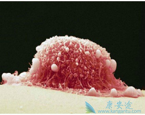 hpv是什么意思?什么样的人应该接种HPV疫苗?