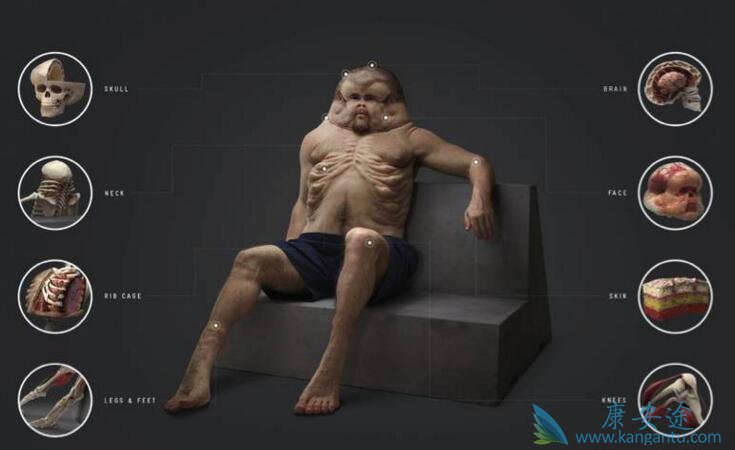 Meet Graham车祸幸存者