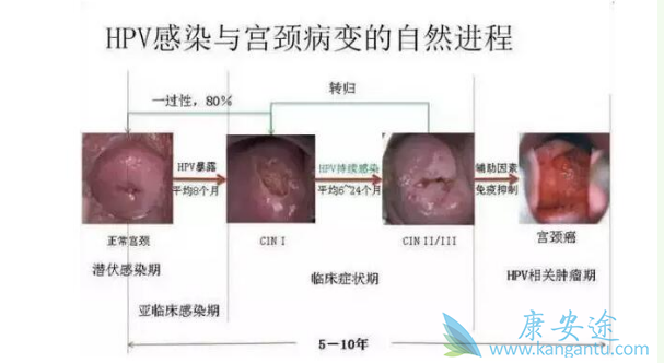 女性自21岁起,建议定期检查HPV病毒