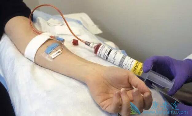 癌症治疗 免疫疗法