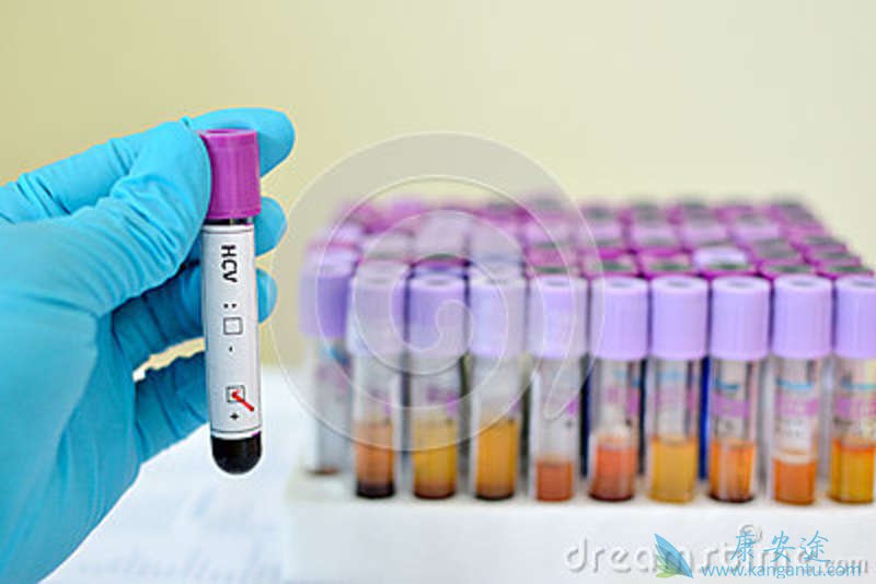 <a href='http://hcv.kangantu.org/' style='color: rgb(0, 176, 240);'></a>Ԥ