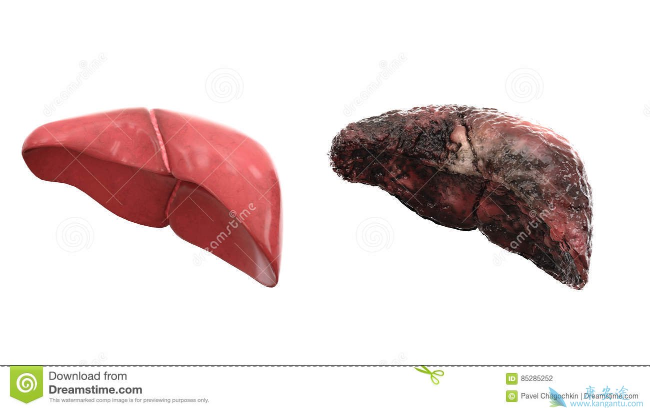 <a href='http://hcv.kangantu.org/' style='color: rgb(0, 176, 240);'></a>Σ